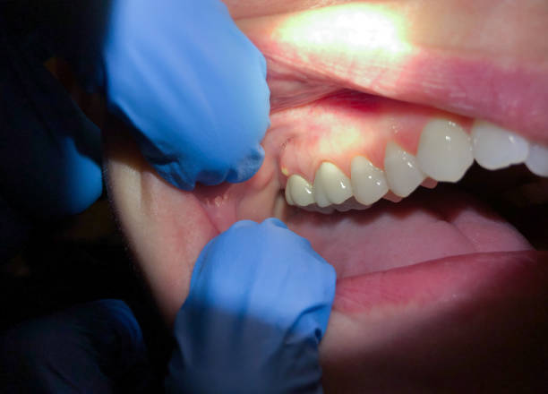 Best 24-Hour Emergency Dentist in Curwensville, PA