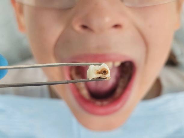 Best Weekend Emergency Dentist in Curwensville, PA